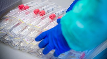 Testsets mit Abstrichstäbchen liegen in einem Testzentrum für Corona-Verdachtsfälle. / Foto: Jens Büttner/dpa-Zentralbild/dpa/Symbolbild