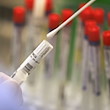 Ein Abstrich wird in einem Labor auf das Coronavirus untersucht. / Foto: Oliver Berg/dpa/Symbolbild