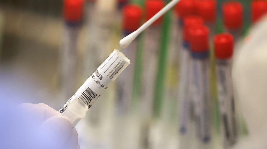 Ein Abstrich wird in einem Labor auf das Coronavirus untersucht. / Foto: Oliver Berg/dpa/Symbolbild