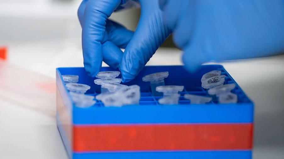 Eine Laborantin sortiert Proben. / Foto: Christophe Gateau/dpa/Symbolbild