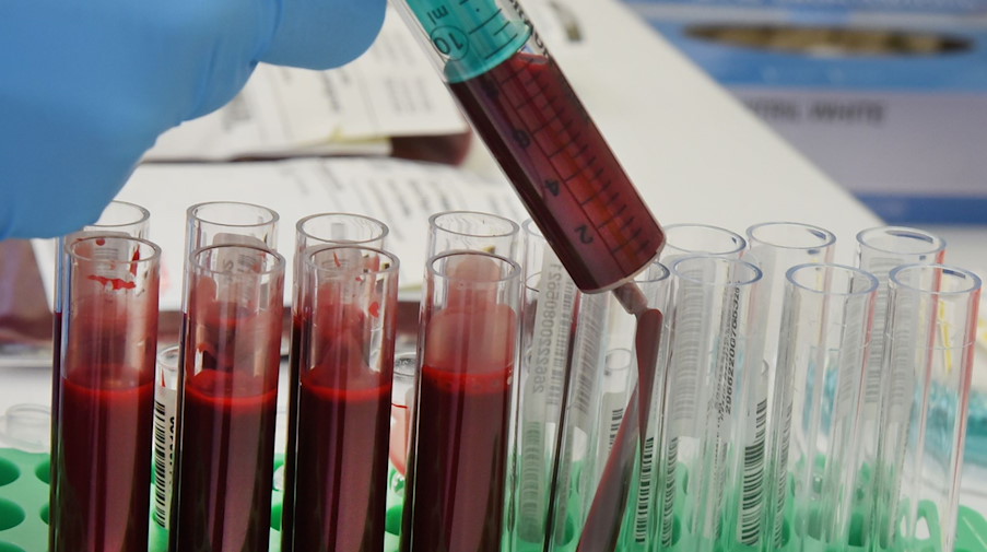 Eine Mitarbeiterin bereitet im zentralen Labor vom Blut- und Plasmaspendendienst Haema AG eie Probenziehung von Blut vor. / Foto: Waltraud Grubitzsch/dpa-Zentralbild/dpa