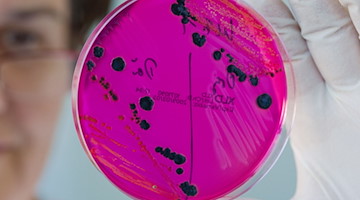 So sieht eine Laborprobe aus, in der Salmonellen nachgewiesen worden sind. / Foto: Patrick Pleul/dpa-Zentralbild/dpa-tmn/Archivbild