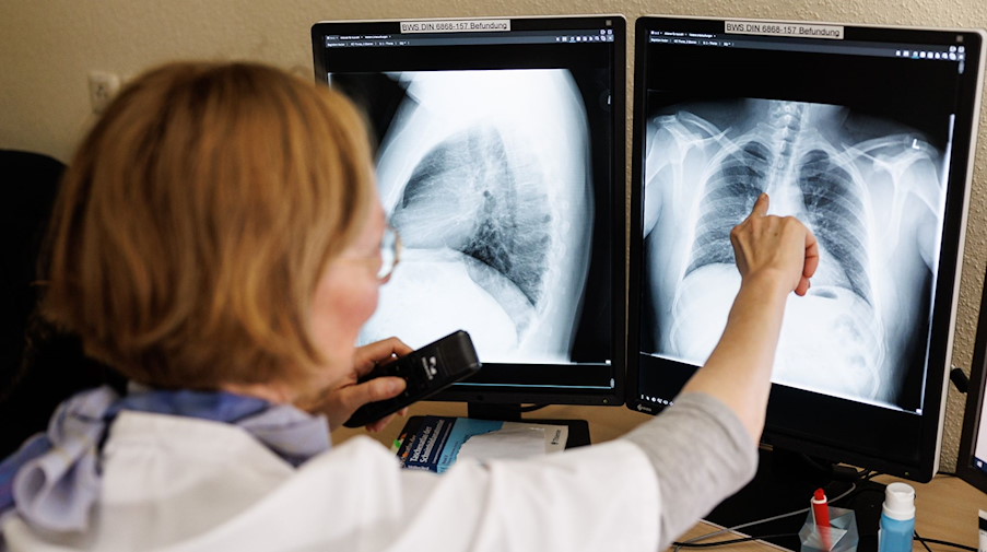 Eine Radiologin analysiert in ihrem Büro in der Lungenklinik Gauting Röntgenbilder einer Lunge. / Foto: Matthias Balk/dpa/Symbolbild