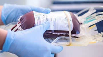 Eine Mitarbeiterin eines Blutspendezentrums hält eine Blutkonserve in den Händen. / Foto: Marius Becker/dpa/Symbolbild