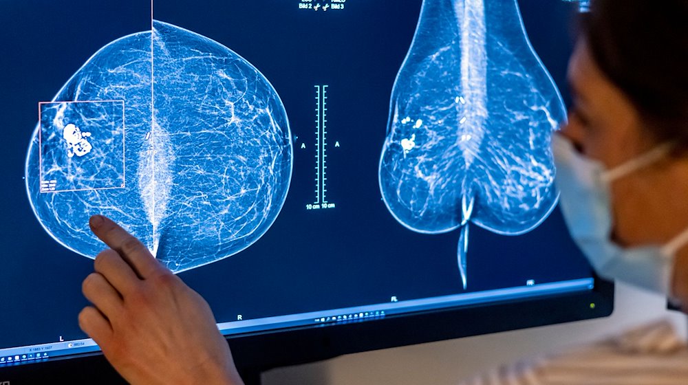Medizinisches Personal untersucht mit einer Mammografie die Brust einer Frau auf Brustkrebs. / Foto: Hannibal Hanschke/dpa