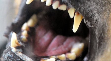 Укуси собак: Дитячий хірург закликає до кращого захисту дітей (символічне зображення). / Фото: Soeren Stache/dpa-Zentralbild/dpa