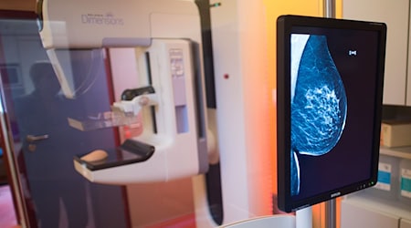 Alle zwei Jahre erhalten Frauen zwischen 50 und 75 eine Einladung zum Mammografie-Screening. (Symbolbild) / Foto: Klaus-Dietmar Gabbert/dpa-Zentralbild/dpa