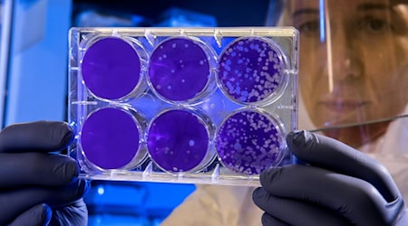 Symbolbild Stammzellen (Foto von CDC auf Unsplash)