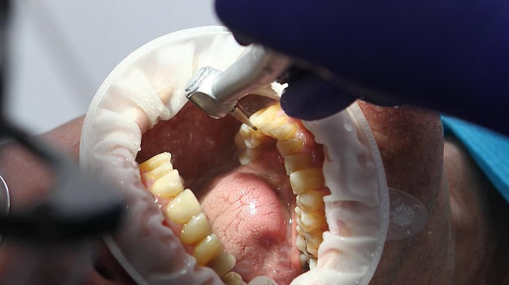 Symbolbild Zähne / pixabay diegotoralabad