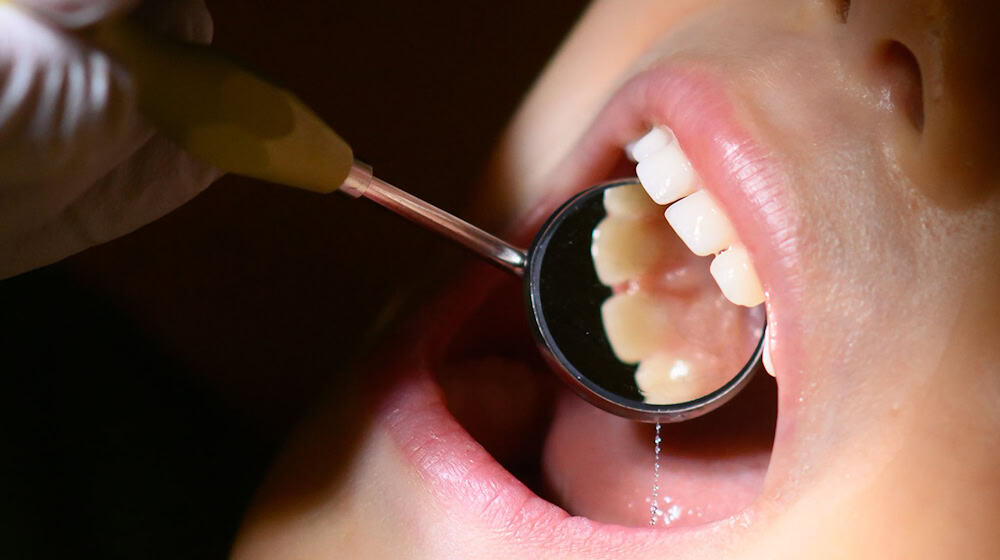 Saxony wants to attract more dentists to rural areas with a quota system (symbolic image).  / Photo: Julian Stratenschulte/dpa