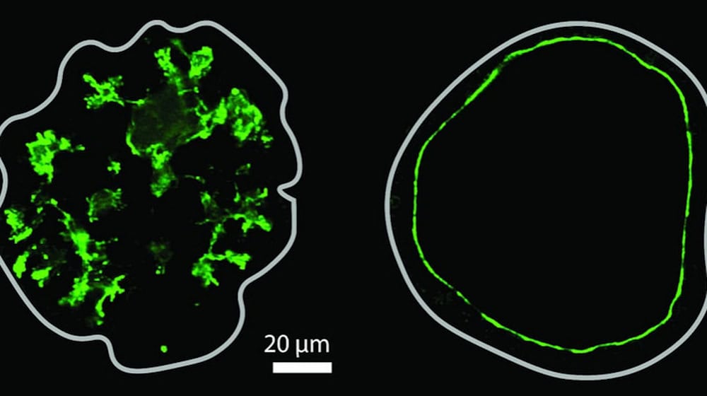 This is what cavities in the pancreas look like under the microscope: star-shaped branching on the left, round on the right. The green coloring shows the inner walls. Byung Ho Lee et al / MPI-CBG / Nature 2025