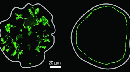 So sehen Hohlräume in der Bauchspeicheldrüse unter dem Mikroskop aus: links sternförmig verzweigt, rechts rund. Die grüne Färbung zeigt die Innenwände. © Byung Ho Lee et al. / MPI-CBG / Nature 2025