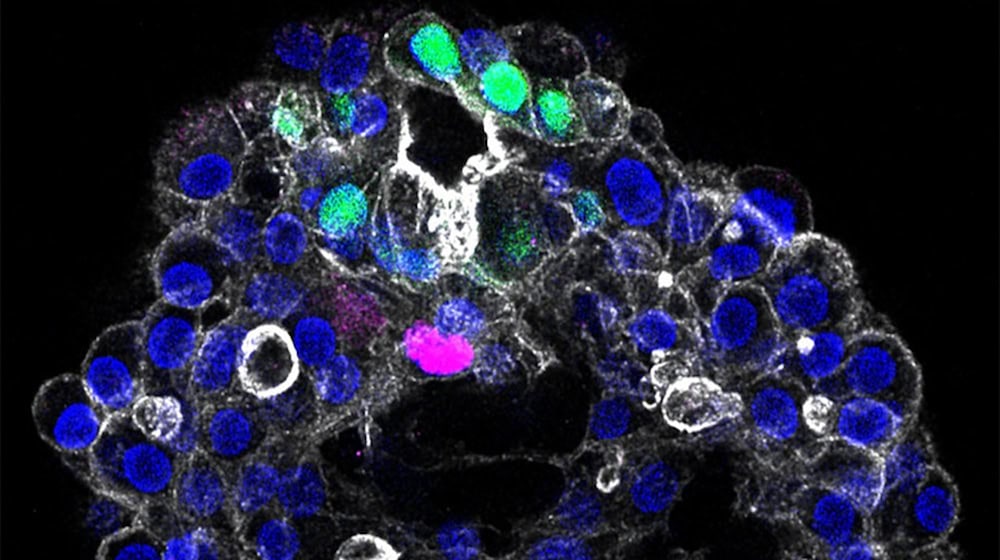 The mini-liver from the petri dish, with the three most important cell types of the liver: portal fibroblasts (magenta), cholangiocytes (green) and hepatocyte nuclei (blue).  Lei Yuan, Sagarika Dawka, Yohan Kim, Anke Liebert et al. / Nature (2025) / MPI-CBG