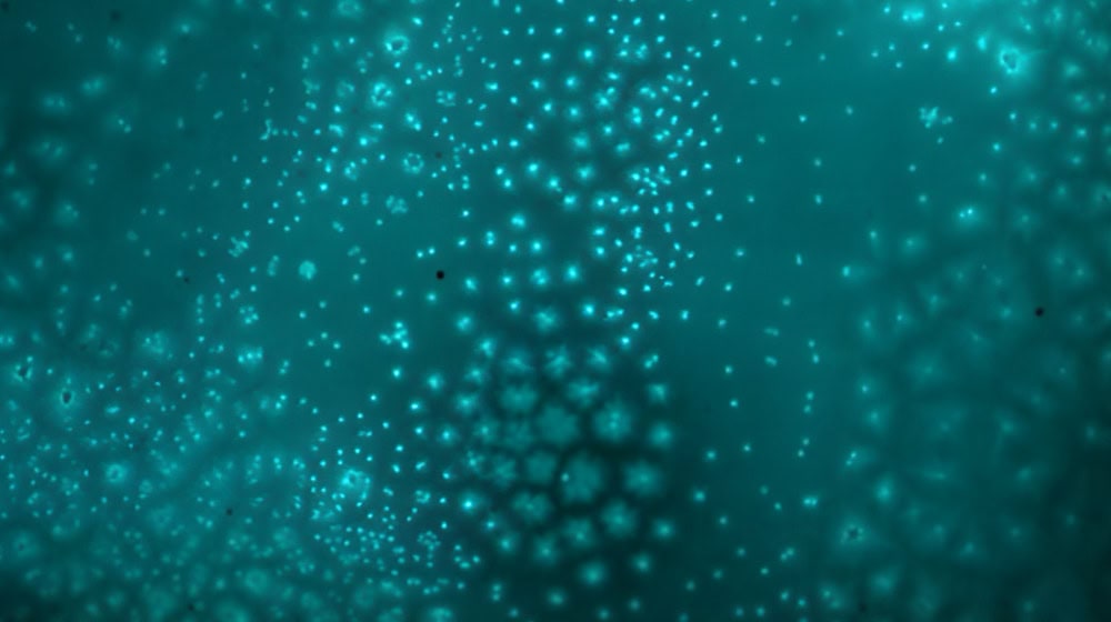 Star-shaped structures of microtubules divide the cell material in early embryos. Researchers at TU Dresden have investigated how this process works. Melissa Rinaldin