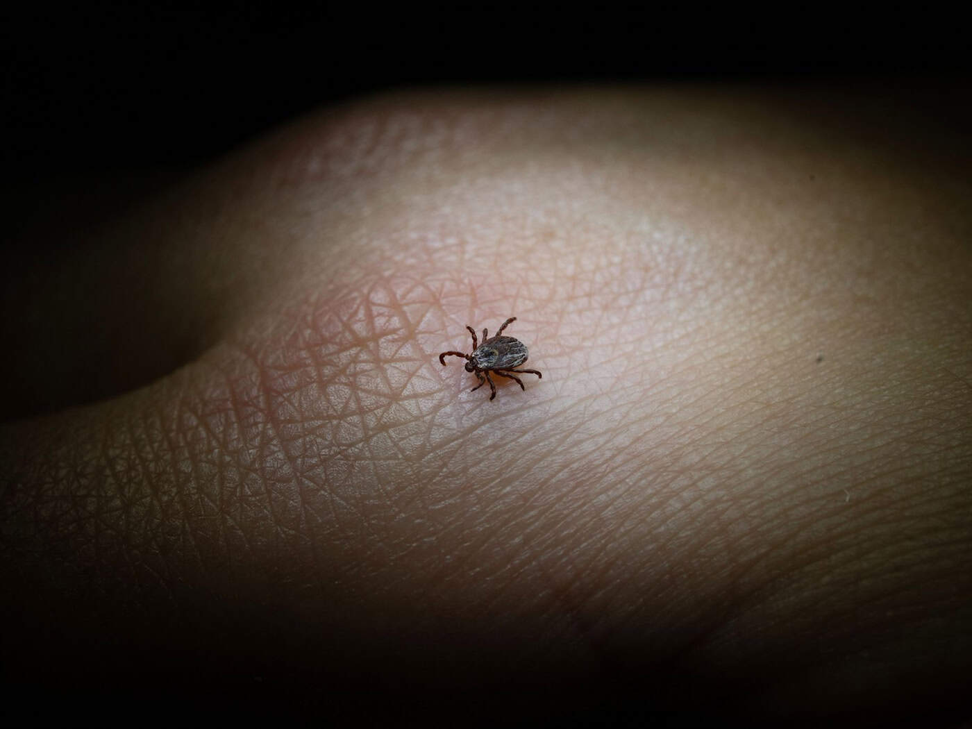Die FSME-Viren werden hauptsächlich durch Zeckenstiche übertragen. (Archivbild) / Foto: Marijan Murat/dpa