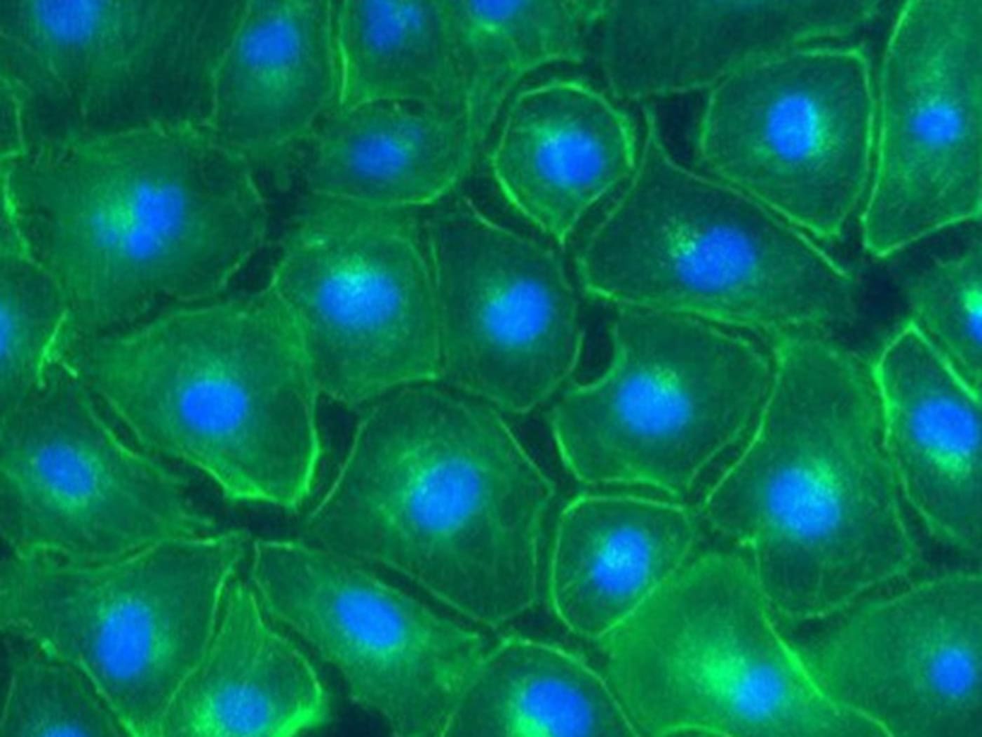 So sieht Zellschaden aus: Fluoreszenzmikroskopische Aufnahme von Nierenzellen, nachdem sie Americium ausgesetzt wurden.