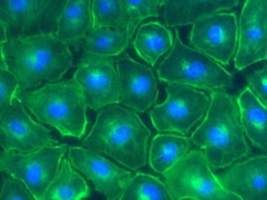 This is what cell damage looks like: Fluorescence microscope image of kidney cells after they have been exposed to americium.