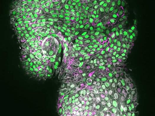 Green or pink: The new Dresden liver model shows both cell types of the liver simultaneously for the first time.