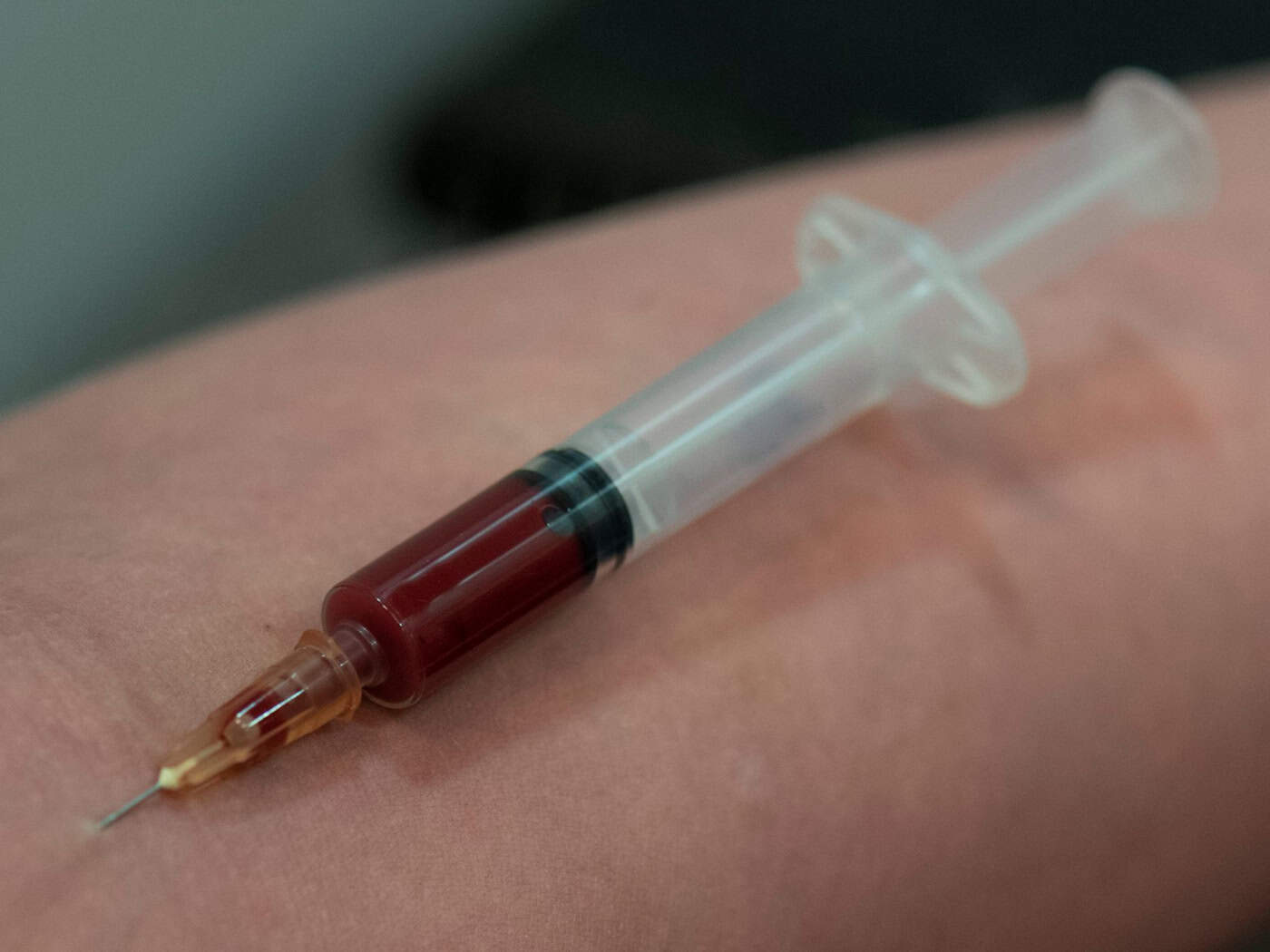 20 drogowych drogow w Sakskej - Lěwica wočakuje wjace podpěry