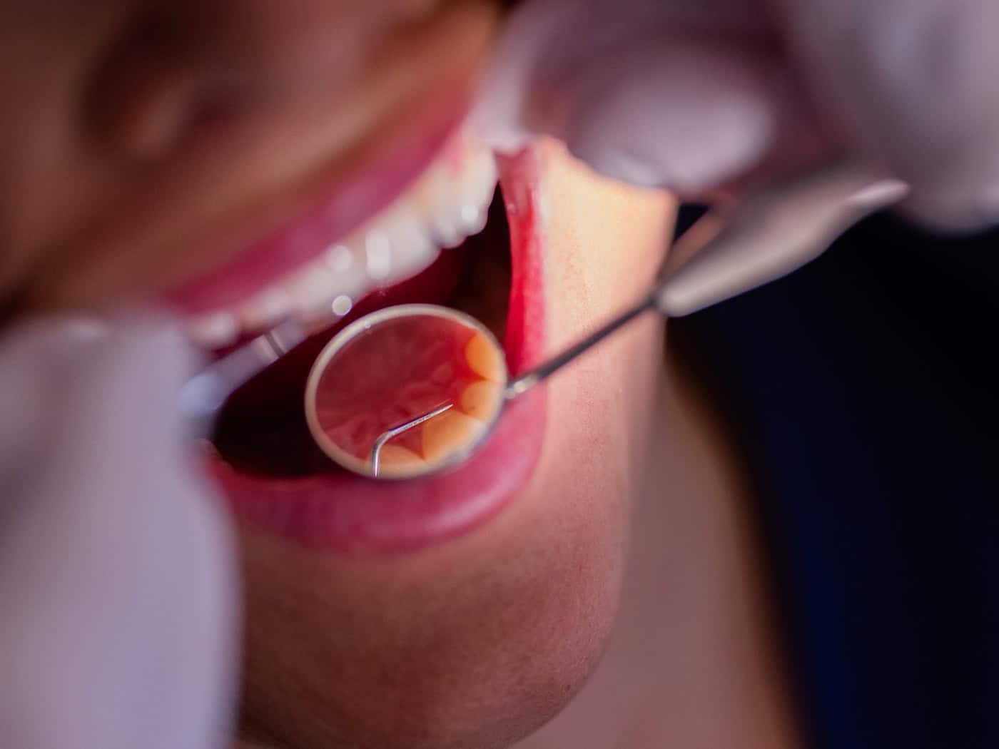 34 applications for places to study to become a regional dentist