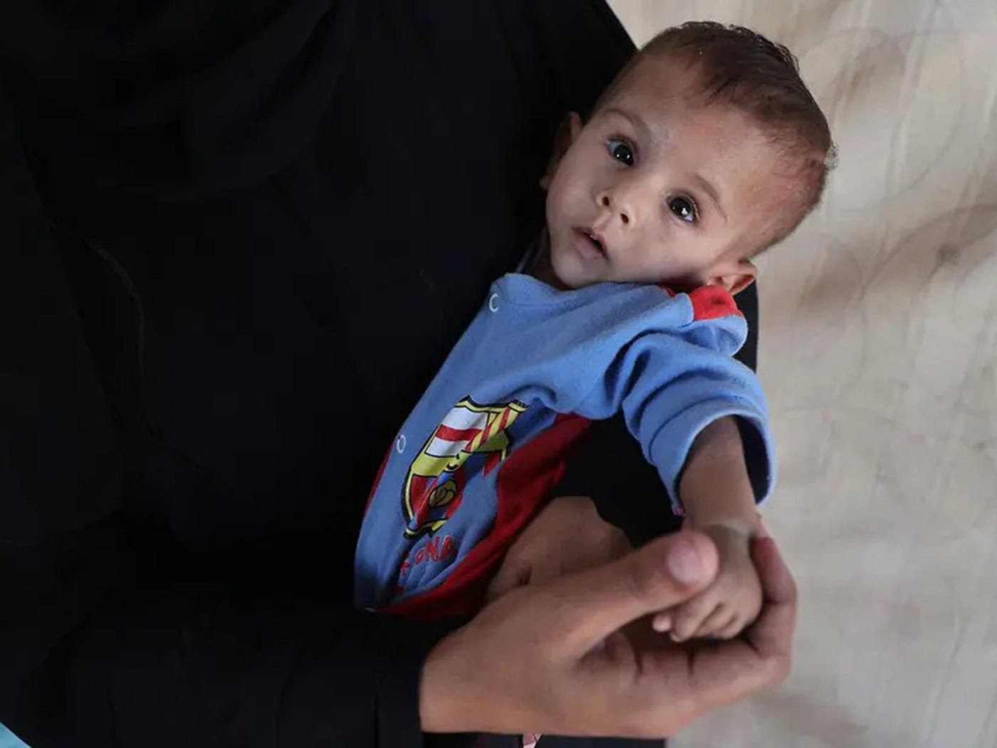 UNICEF Dresden gegen Mangelernährung