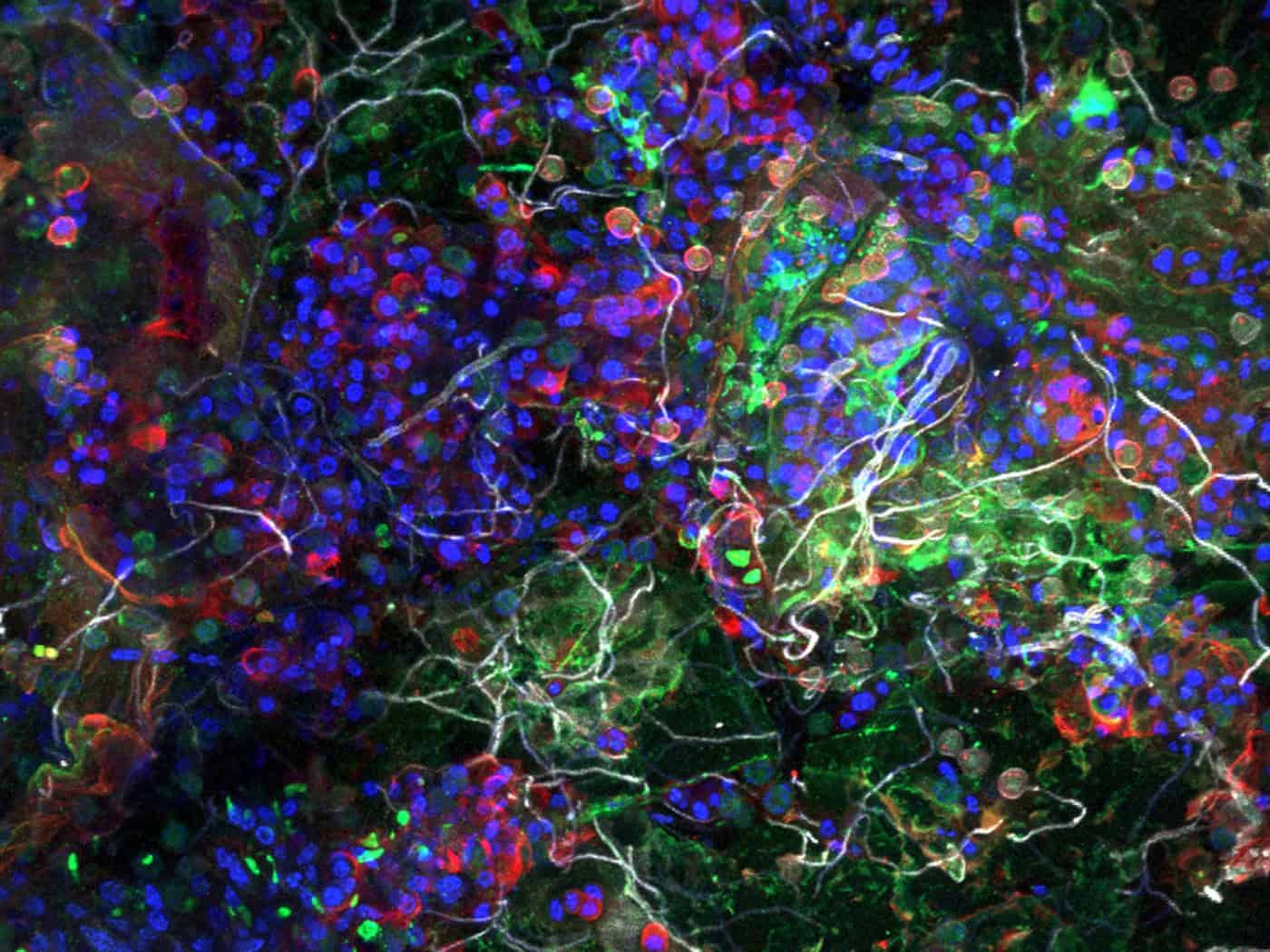Tiny world on plastic: the plastisphere, photographed with a laser microscope.