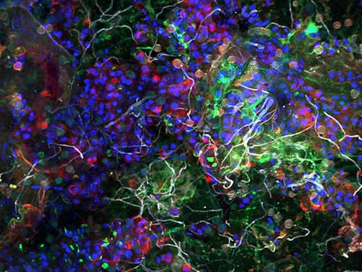 Tiny world on plastic: the plastisphere, photographed with a laser microscope.