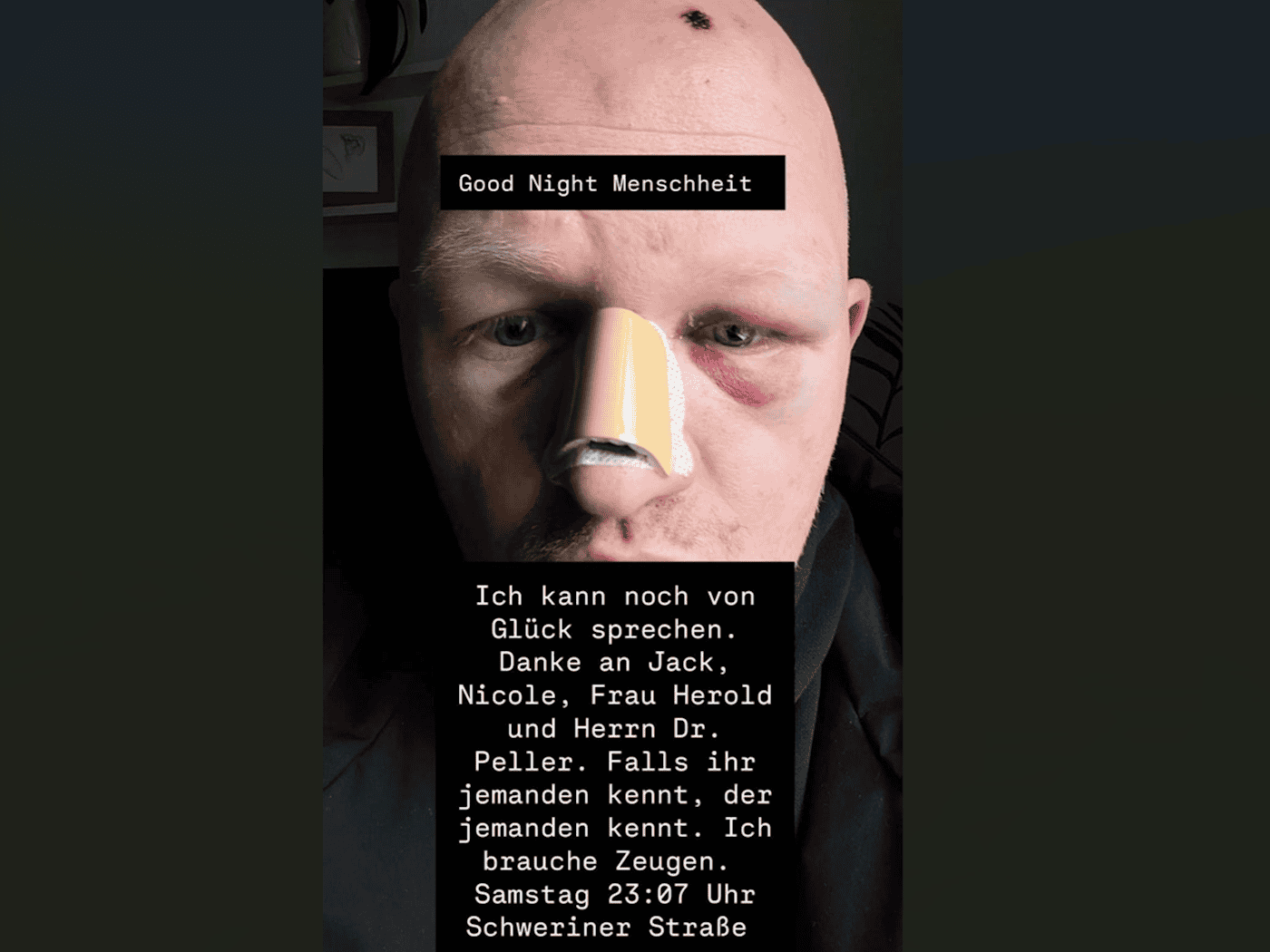 Nahaufnahme eines Mannes mit deutlichen Verletzungen im Gesicht: Die Nase ist großflächig mit einem beigefarbenen Pflaster fixiert, beide Augen weisen starke dunkle Hämatome und Schwellungen auf. Auf dem Kopf ist eine kleine Kruste erkennbar. Das Bild enthält Texteinblendungen, die sich bei Zeugen b