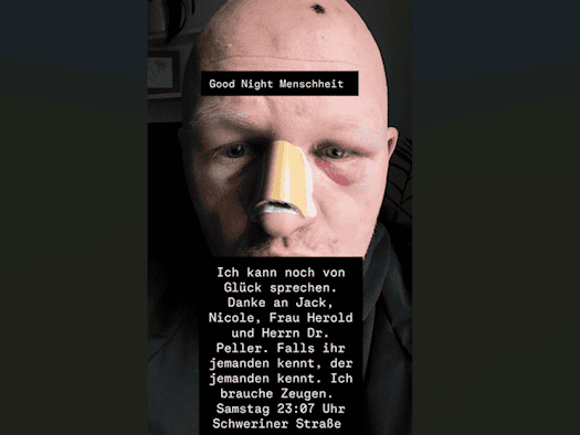 Nahaufnahme eines Mannes mit deutlichen Verletzungen im Gesicht: Die Nase ist großflächig mit einem beigefarbenen Pflaster fixiert, beide Augen weisen starke dunkle Hämatome und Schwellungen auf. Auf dem Kopf ist eine kleine Kruste erkennbar. Das Bild enthält Texteinblendungen, die sich bei Zeugen b