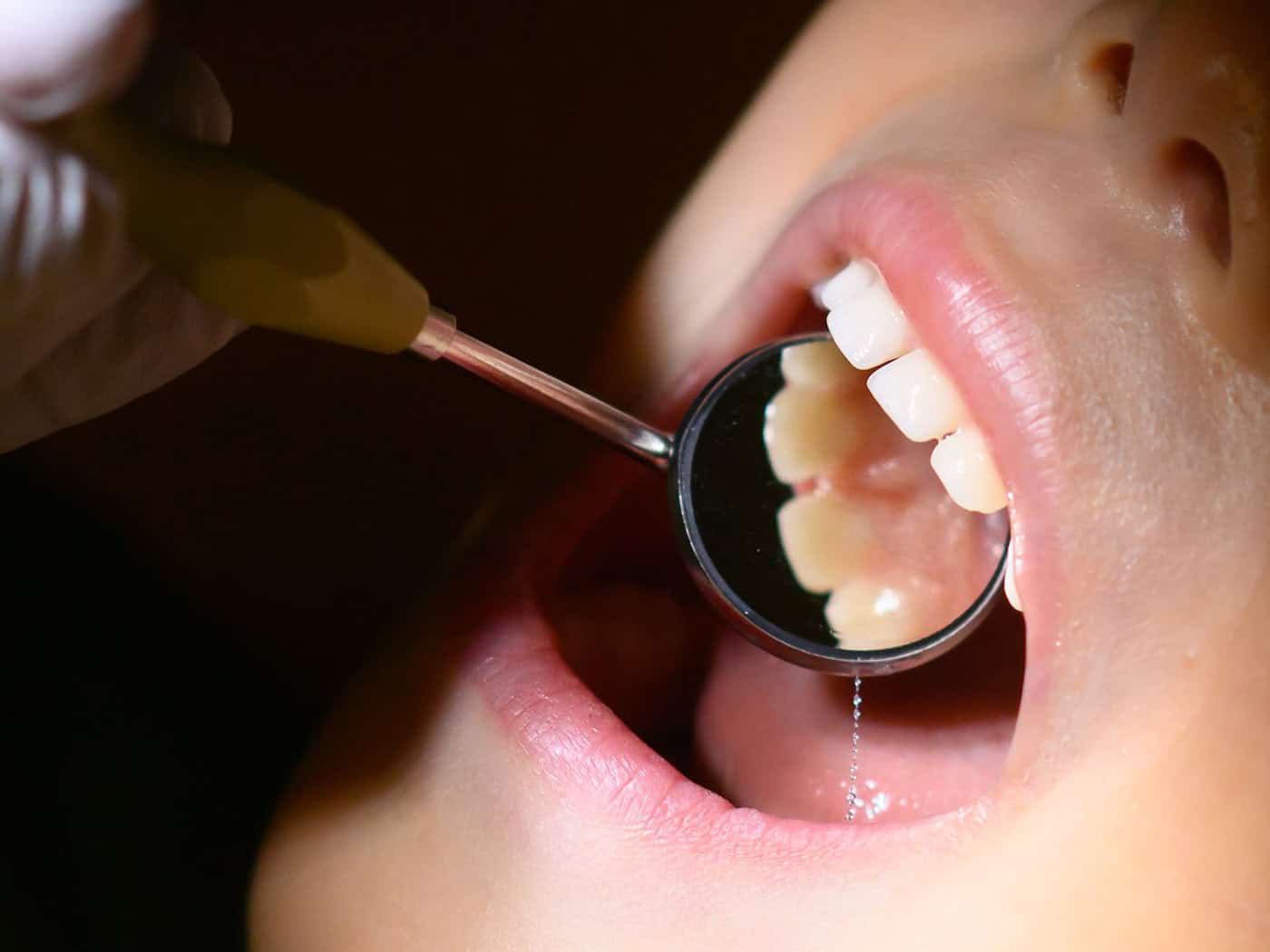 Quota for dentists in rural areas - applications still possible