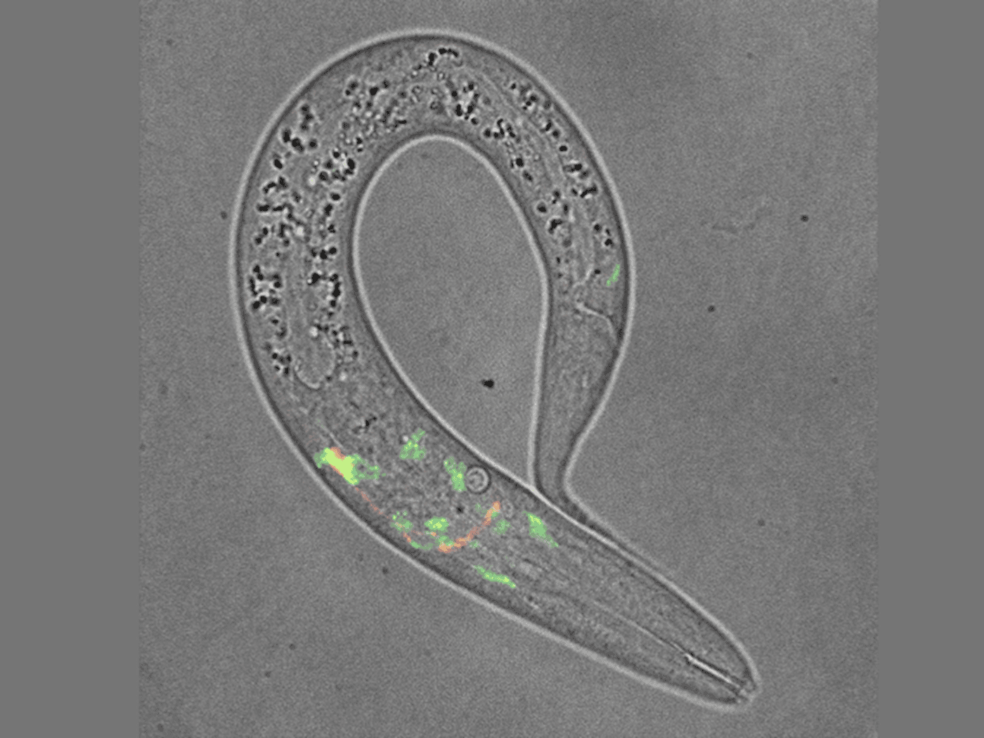 302 Nervenzellen, ein Schlaf-Neuron, große Erkenntnisse: C. elegans hilft Dresdner Forschern, die Geheimnisse des Schlafs zu entschlüsseln.