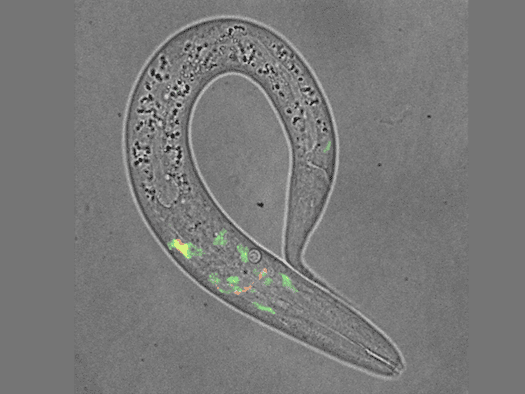 302 Nervenzellen, ein Schlaf-Neuron, große Erkenntnisse: C. elegans hilft Dresdner Forschern, die Geheimnisse des Schlafs zu entschlüsseln.