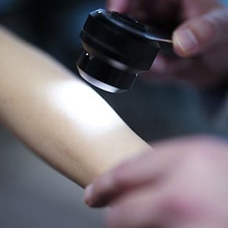 Rakovina kůže v Sasku: kritika omezení včasného záchytu