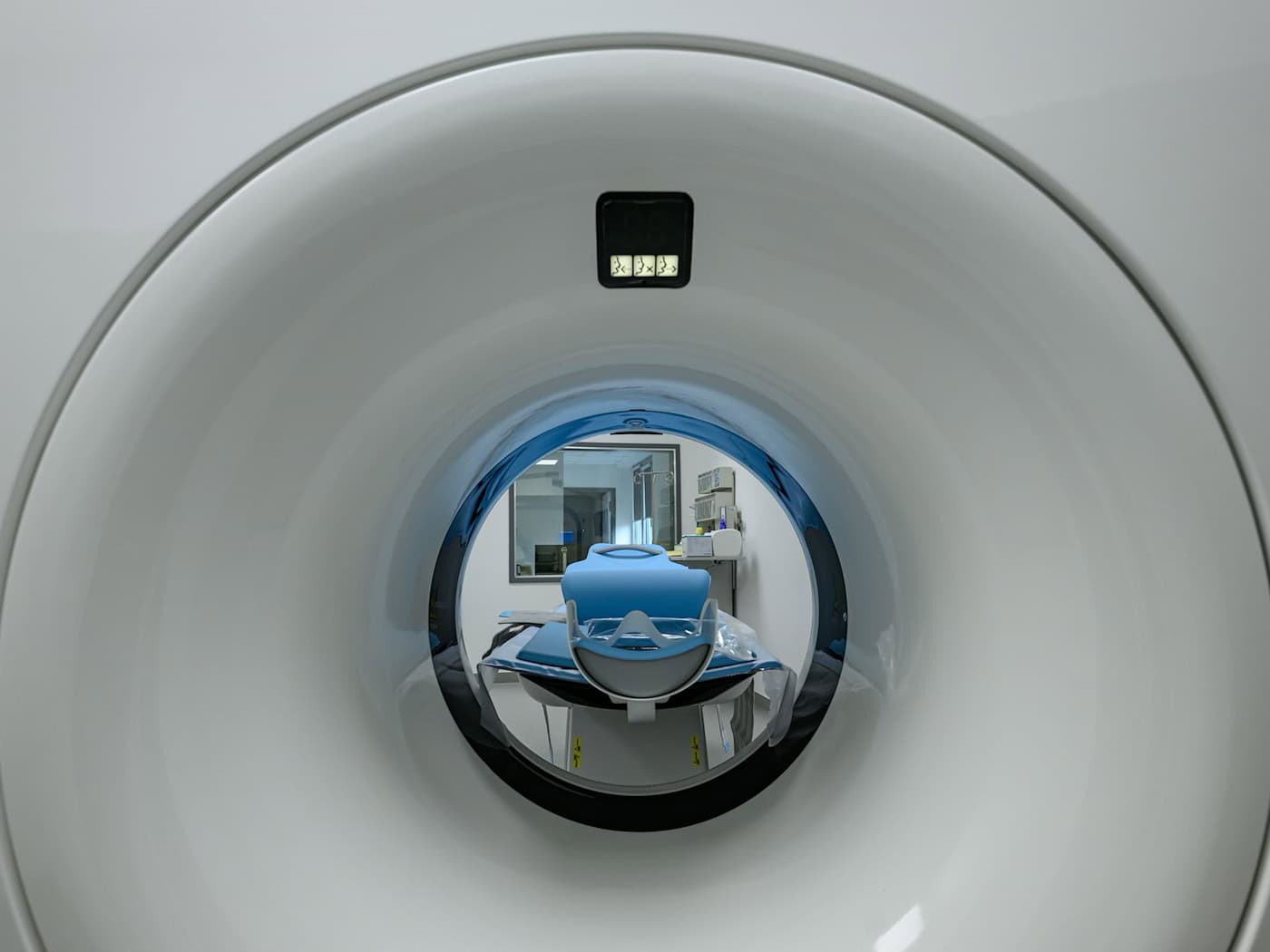 Sasko spouští program hrazený zdravotní pojišťovnami zaměřený na včasnou diagnostiku rakoviny plic