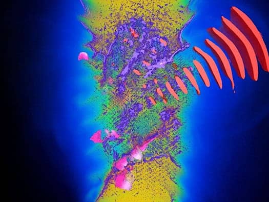 So könnte künftig Krebs behandelt werden. Die Simulation zeigt, wie ein Laser Protonen auf hohe Energien beschleunigt. Auf dem Supercomputer Discovery soll das berechnet werden.