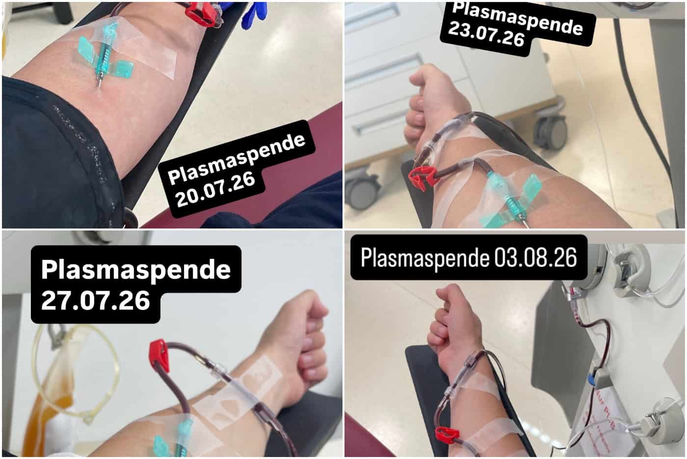 Dokumentierte Plasmaspenden zur Finanzierung des Kurzfilms „Thicker Than Blood“ Collage von vier Fotos, die Unterarme mit Zugängen bei der Plasmaspende im Krankenhaus zeigen. Überlagerte Textfelder zeigen Spendendaten zwischen Juli und August 2026.
