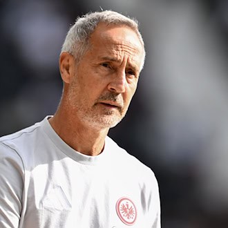 Eintracht-Coach Hütter beschäftigt mehr als die Systemfrage