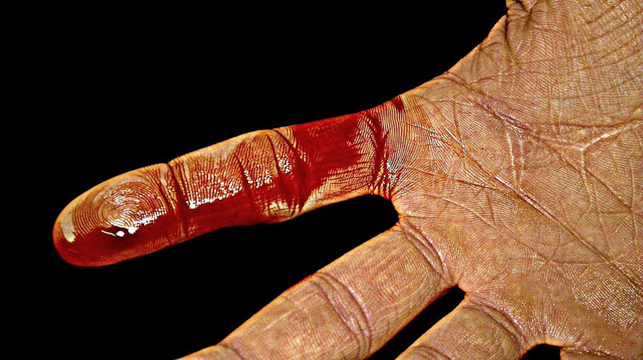 Busunfall auf der Zwinglistraße mit Verletzten